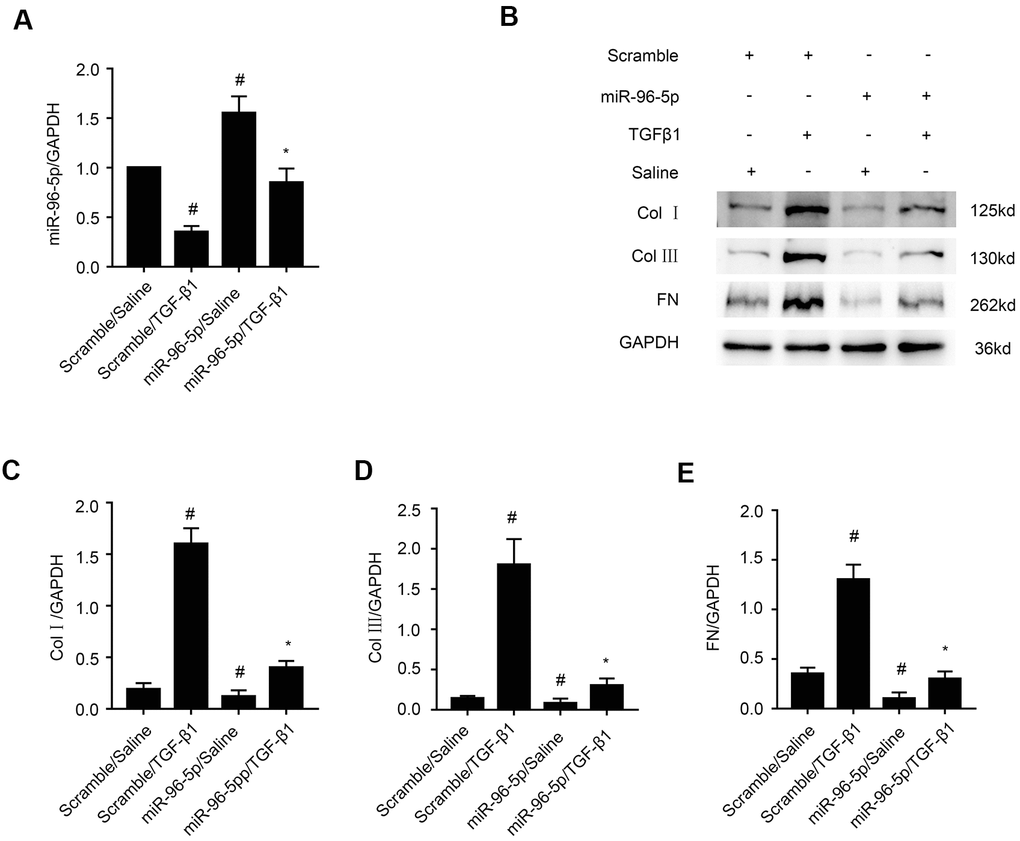 MiR-96-5p inhibits TGF-β1-induced expression of collagen I, collagen III, and fibronectin. (A) RT-qPCR analysis shows miR-96-5p expression levels in BUMPT cells transfected with 100 nM miR-96-5p mimics or scrambled miRNA, and then treated with or without TGF-β1 for 24h. (B) Representative western blot images and (C–E) densitometric measurements show (B, C) collagen I, (B, D) collagen III, and (B, E) fibronectin protein levels in BUMPT cells transfected with 100 nM miR-96-5p mimics or scrambled miRNA, and then treated with or without TGF-β1 for 24h. Note: The data are expressed as means ±SD (n = 6). # denotes p  when comparing scrambled miRNA plus TGF-β1 group or miR-96-5p mimics plus saline group vs. scrambled miRNA plus saline group; * denotes p when comparing miR-96-5p mimics plus TGF-β1group vs. scrambled miRNA plus TGF-β1 group.