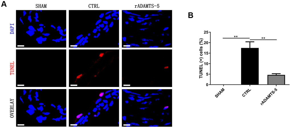 Decreased apoptosis in the IA arteries of rADAMTS-5-administered mice. (A) Representative images of TUNEL staining indicating less apoptosis (displayed in red) in arteries from rADAMTS-5-administered mice than in those from control (CTRL) mice. (B) Quantification of the TUNEL (+) cells in arteries from the control (CTRL) mice and rADAMTS-5-administered mice. **P