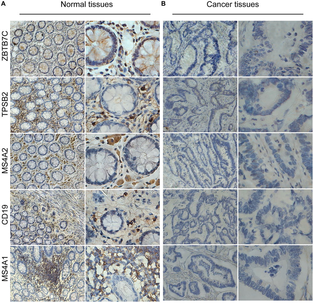 The protein levels of ZBTB7C and gene markers in colorectal cancer (A) and adjacent (B) tissues.