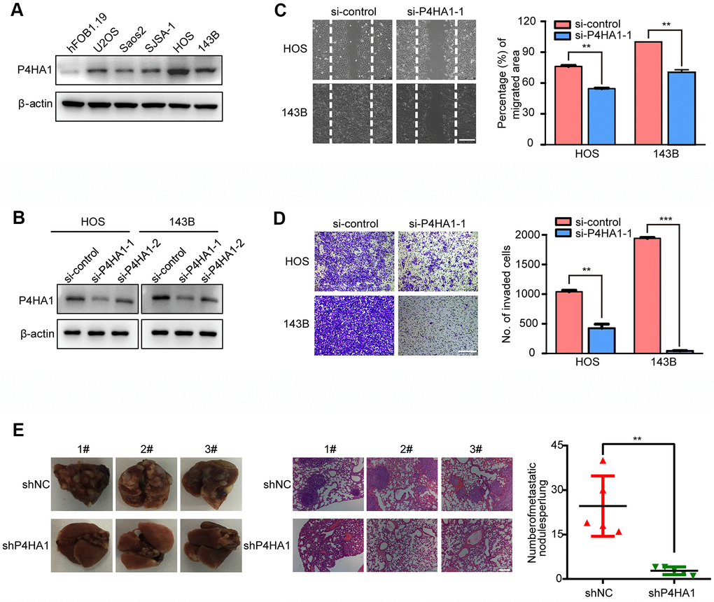 P4HA1 promoted the metastasis of OS in vitro. (A) Western blotting analysis of the expression of P4HA1 in human osteoblastic cell line and osteosarcoma cell lines. (B) Western blotting analysis of the expression of P4HA1 in HOS and 143B cell lines after transfection of si-control, si-P4HA1-1 and si-P4HA1-2. (C) Wound healing assay analysis in HOS and 143B cell lines after transfection of si-control and si-P4HA1-1. Representative images of migration were shown in the right panel. The degrees to which the wounds healed was shown in the histogram. (D) Transwell invasion assay analysis in HOS and 143B cell lines after transfection of si-control and si-P4HA1-1. Representative images of invasion were shown in the right panel. The proportions of invading cells were shown in the histogram. The bars indicate the mean±s.d. Statistically significant differences (t-test), **PE) The number of lung metastasis nodules formed by P4HA1-knockdown 143B cells and control cells in orthotopic osteosarcoma implanted mice was shown in the right panel. Statistically significant differences (t-test), **P