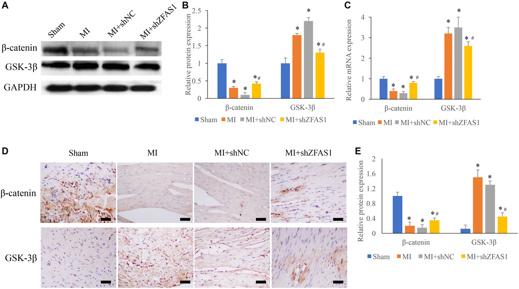 Promotion of Wnt/β-catenin pathway by shZFAS1 in the MI rats. (A) The protein expression of β-catenin and GSK-3β in the myocardial tissues was measured. (B) Influence of shZFAS1 on the protein expression of β-catenin and GSK-3β in the myocardial tissues. (C) Influence of shZFAS1 on the mRNA levels of β-catenin and GSK-3β in the myocardial tissues. (D) The expression of β-catenin and GSK-3β in the myocardial tissues were measured using IHC staining (Scale bar = 500 μm). (E) Influence of shZFAS1 on β-catenin and GSK-3β in the myocardial tissues. *P #P 