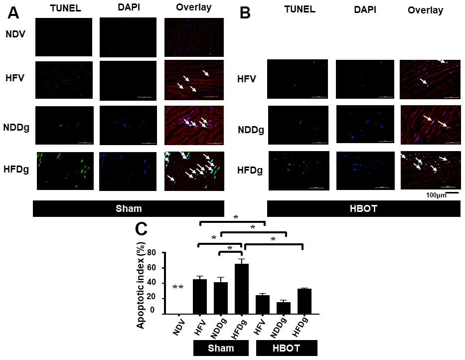 Effect of HBOT on apoptosis using TUNEL staining in cardiomyocytes of pre-diabetic rats after induction of aging by D-gal. (A) Representative figure of TUNEL positive cells in sham-treated rats. (B) Representative figure of TUNEL positive cells in HBOT-treated rats. (C) Percentage of apoptotic index. NDV, normal diet fed rats with vehicle; NDDg, normal diet fed rats with D-gal; HFV, high-fat diet fed rats with vehicle; HFDg, high-fat diet fed rats with D-gal; TUNEL, Terminal deoxynucleotidyl transferase dUTP nick end labeling; HBOT, hyperbaric oxygen therapy. (n = 3/group). *P **P 