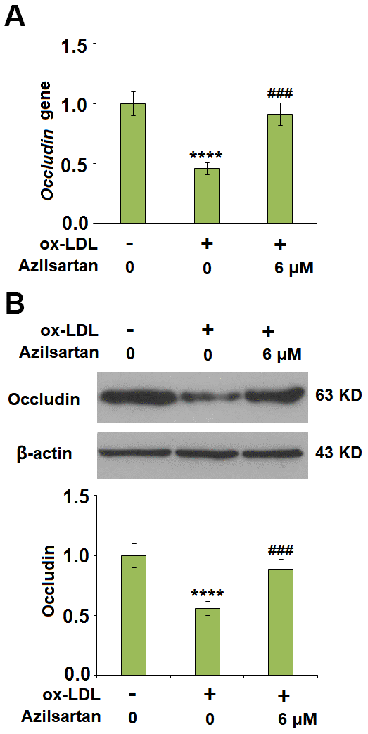 Azilsartan mitigated ox-LDL-induced expression of occludin. Cells were stimulated with ox-LDL (100 μg/mL) in the presence or absence of Azilsartan (6 μM) for 24 hours. (A) Gene expression of Occludin; (B) Protein of Occludin (****, P