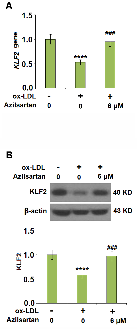 Azilsartan restored ox-LDL-induced reduction of KLF2 in HUVECs. Cells were stimulated with ox-LDL (100 μg/mL) in the presence or absence of Azilsartan (6 μM) for 24 hours. (A) Gene expression of KLF2; (B) Protein of KLF2 (****, P