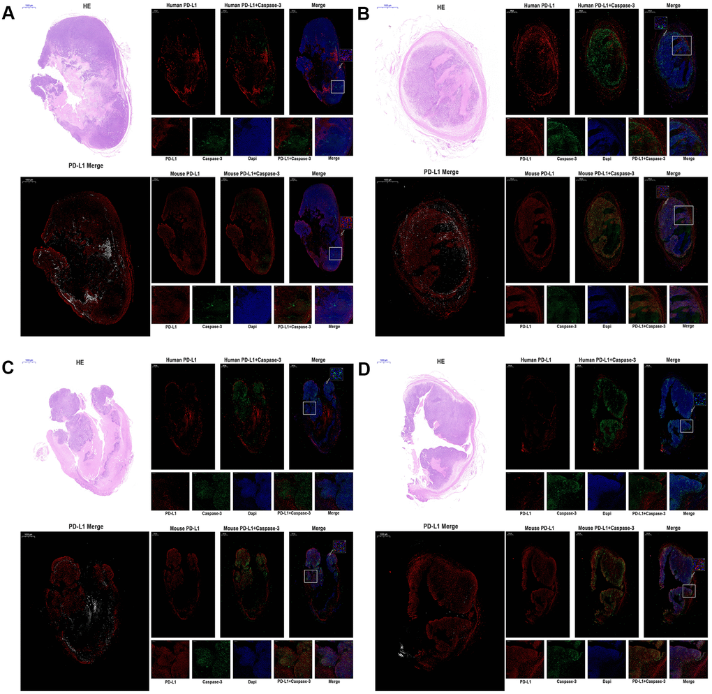 The expression of human PD-L1, mouse PD-L1, and Caspase-3 were detected by immunofluorescence of MC38 tumors (n=3, Scale bar=1000 μm). (A) MC38-hPD-L1 control (B) MC38-hPD-L1 (C) MC38-hPD-L1/KO (D) MC38-KO Human PD-L1 or Mouse PD-L1 was indicated by red signals; Caspase-3 in tumor or tumor-host was indicated by green signals; nuclei, blue 4’,6-diamidino-2-phenylindole (DAPI) signals. HE staining: upper left. PD-L1 Merge: lower left (Mouse PD-L1, red; Human PD-L1, gray). Local amplifies the area indicated by the white box. Scale bar=200 μm. Inset amplifies the area indicated by the white arrow. Scale bar=50 μm.