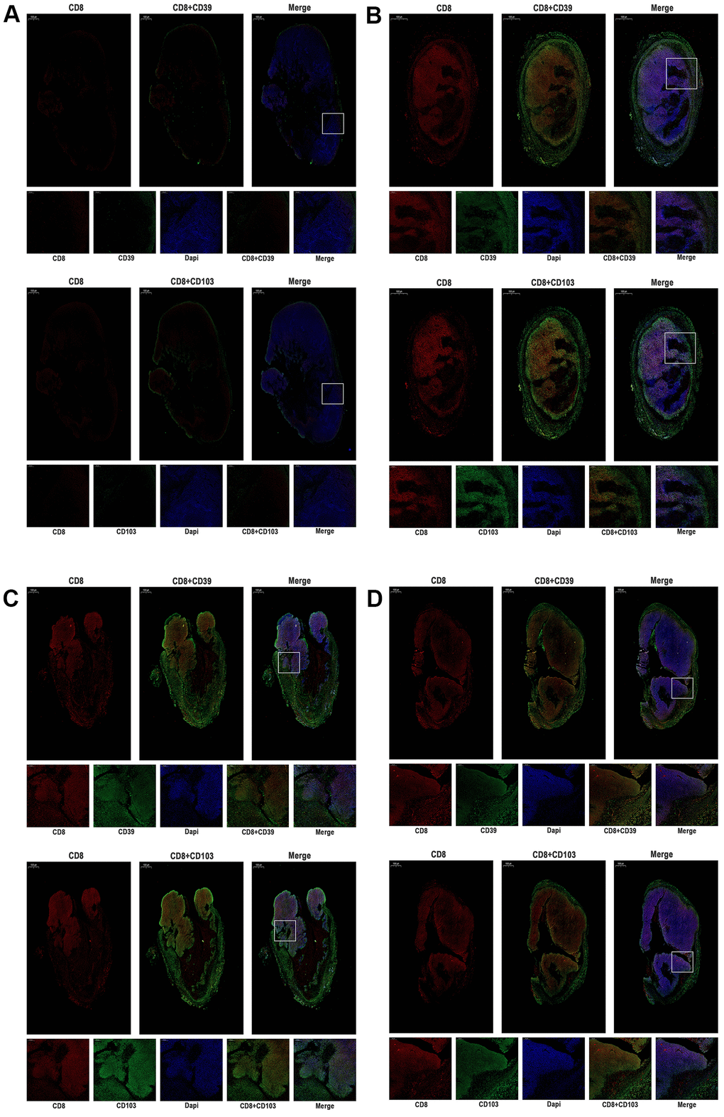 The expression of CD39, CD103, and CD8 were tested by immunofluorescence of MC38 tumors (n=3, Scale bar=1000 μm). (A) MC38-hPD-L1 control (B) MC38-hPD-L1 (C) MC38-hPD-L1/KO (D) MC38-KO CD8 was indicated by red signals; CD39 or CD103 was indicated by green signals; nuclei, blue 4’,6-diamidino-2-phenylindole (DAPI) signals. Local amplifies the area indicated by the white box. Scale bar=200 μm.