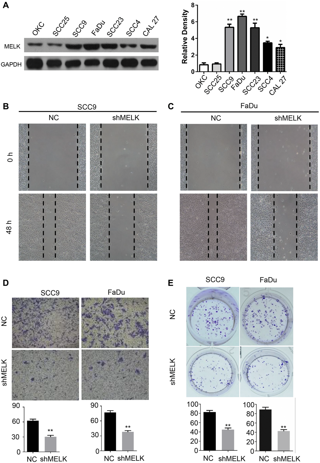 MELK downregulation impedes growth of OSCC cells. (A) Representative western blotting after transfection of shMELK in OKC and OSCC cell lines. Cell mobility of MELK knockdown in SCC9 (B) and FaDu (C) cell lines. (D) Iconic images and quantification of invaded cells. (E) Typical images and quantification of anchor-dependent colony formation. **P 
