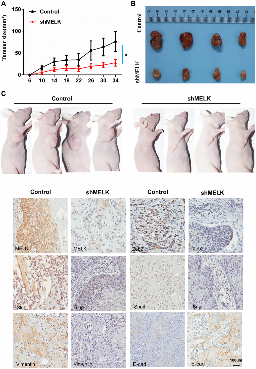 MELK downregulation attenuates OSCC xenograft tumour growth in nude mice. (A) Tumour growth curves for shMELK and NC mice. (B) Dissected tumours were photographed. (C) Representative images of IHC staining among MELK, Zeb2, Slug, Snail, Vimentin and E-cad in tumours; scale bar: 100 μm. *P **P 