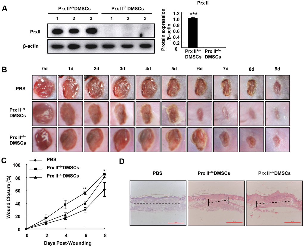 Prx II−/− DMSCs showed less skin wound healing than Prx II+/+ DMSCs. (A) Prx II protein-expression levels in Prx II+/+ and Prx II−/− DMSCs. (B) Overall observed morphological changes in wound healing after treatment. (C) Wound-area changes observed during wound healing. *p p −/− DMSCs. The data shown represent the mean ± SD (n = 6). (D) Histological images (H&E staining) of wounds. Wounds are indicated with dashed imaginary lines.