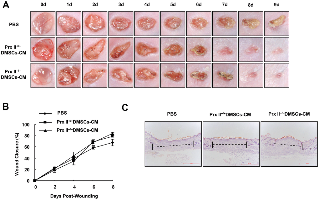 Prx II+/+ DMSC-CM and Prx II−/−DMSC-CM promoted skin wound healing. (A) Overall morphological changes observed during wound healing after treatment. (B) Wound-area changes observed during wound healing *p p −/− DMSC-CM. The data shown represent the mean ± SD (n = 6). (C) Histological images (H&E staining) of wounds. Wounds are indicated with dashed lines.
