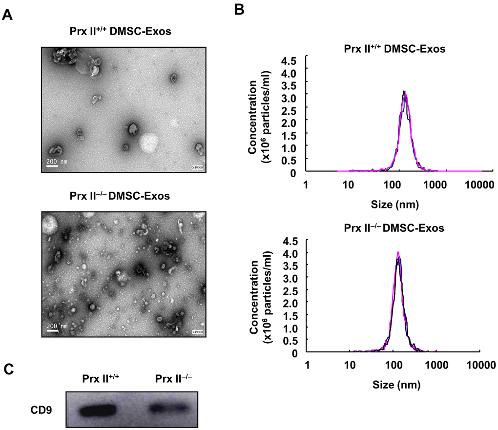 Extraction and identification of Prx II+/+ DMSC-Exos and Prx II−/− DMSC-Exos. (A) Morphological observations of exosomes by electron microscopy. (B) Particle-size analysis of exosomes based on flow cytometry. (C) Western blot analysis of exosomal extracts to investigate the expression of surface markers.