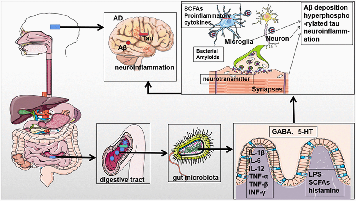 Gut Microbial Involvement In Alzheimers Disease Pathogenesis Figure F1 Aging