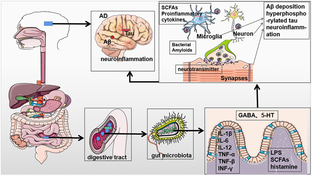 Potential contribution of the gut microbiota to the pathogenesis of Alzheimer's disease. The gut microbiota can affect the occurrence and progression of AD through metabolites, neurotransmitters, and proinflammatory mediators to promote Aβ aggregation, accumulation of hyperphosphorylated tau, and chronic neuroinflammation. Parts of the figure are adapted from SMART (Servier Medical Art: https://smart.servier.com), licensed under a Creative Common Attribution 3.0 Generic License.
