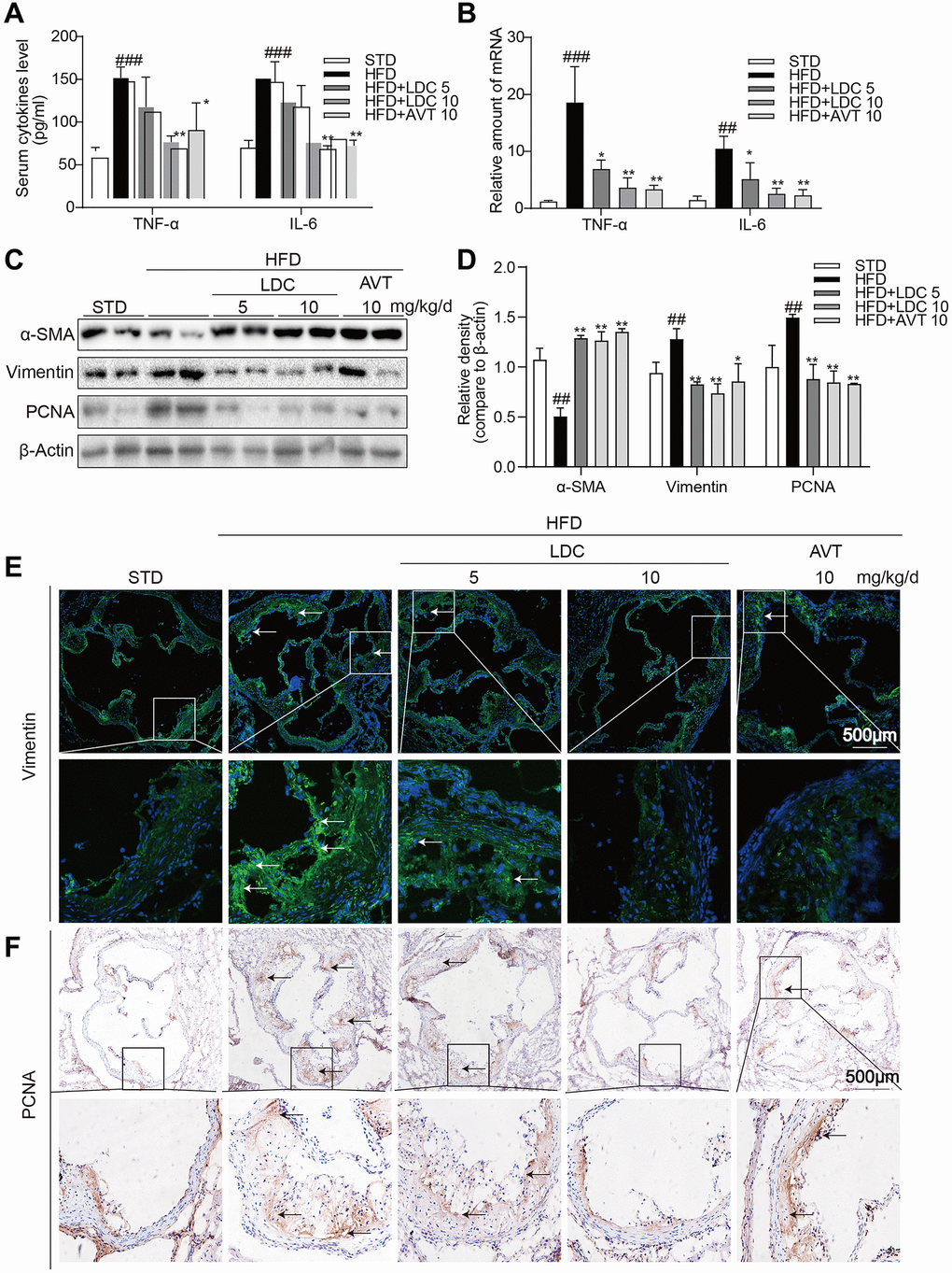 CDK9 inhibitor reduces HFD-induced inflammation phenotype switch of VSMCs in vivo. (A) TNF-α and IL-6 protein levels in the serum were detected using ELISA assay (n = 8; ###p *p **p B) TNF-α and IL-6 mRNA levels in the aorta were detected using real-time qPCR assay (n = 8; ##p ###p *p **p C–D) Western blot assay showed the expressions of α-SMA, Vimentin and PCNA in the whole aorta from ApoE-/- fed a normal (STD) or HFD for 16 weeks. Densitometric quantification for blots was shown in panel D (n = 8; ##p *p **p E) Representative immunofluorescence staining images for Vimentin (green) in aortic roots. Tissues were counterstained with DAPI (blue) (scale bar = 500 μm). (F) Representative images of PCNA staining of aortic roots (scale bar = 500 μm; DAB chromogen staining (brown)).