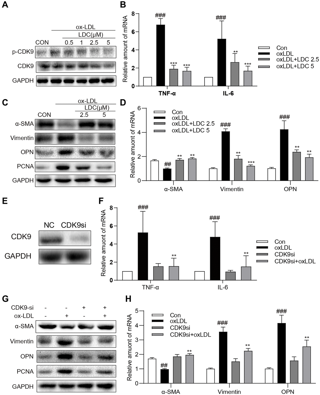 Inactivation of p-CDK9 by CDK9 inhibitor or CDK9-si prevented ox-LDL-induced inflammation and phenotype switch of VSMCs in vitro. (A) LDC000067 suppressed ox-LDL-induced activation of p-CDK9. VSMCs were pretreated with LDC000067 (indicated concentrations) for 1 h and then incubated with ox-LDL (50 μg/mL) for 2 h. The levels of p-CDK9 and CDK9 were detected by western blot. (B–D) VSMCs were treated with LDC000067 (2.5 or 5 μM) for 1 hour and then exposed to ox-LDL (50 μg/mL) for 6 h (in panels B), 24 h (in panels C) or 12 h ((in panels D). (B) The levels of TNF-α and IL-6 were detected using real-time qPCR assay. (C) Expressions of α-SMA, Vimentin, OPN and PCNA in the cultural medium were detected by western blot. (D) The mRNA levels of α-SMA, Vimentin, OPN were detected using real-time qPCR assay (n = 3 ##P ###P *P **P ***P E–H) VSMCs were transfected with siRNA against CDK9 and then incubated with ox-LDL (50 μg/mL) for 6 h (in panels G), 24 h (in panels H) or 12 h ((in panels H). (E) VSMCs were transfected with siRNA against CDK9 for 6 h and then detected expression of CDK9 by western blot. (F) The level of TNF-α and IL-6 were detected using real-time qPCR assay. (G) Expressions of α-SMA, Vimentin, OPN and PCNA in the cultural medium were detected by western blot. (H) The mRNA level of α-SMA, Vimentin, OPN were detected using real-time qPCR assay (n = 3; ##P ###P *P **P 