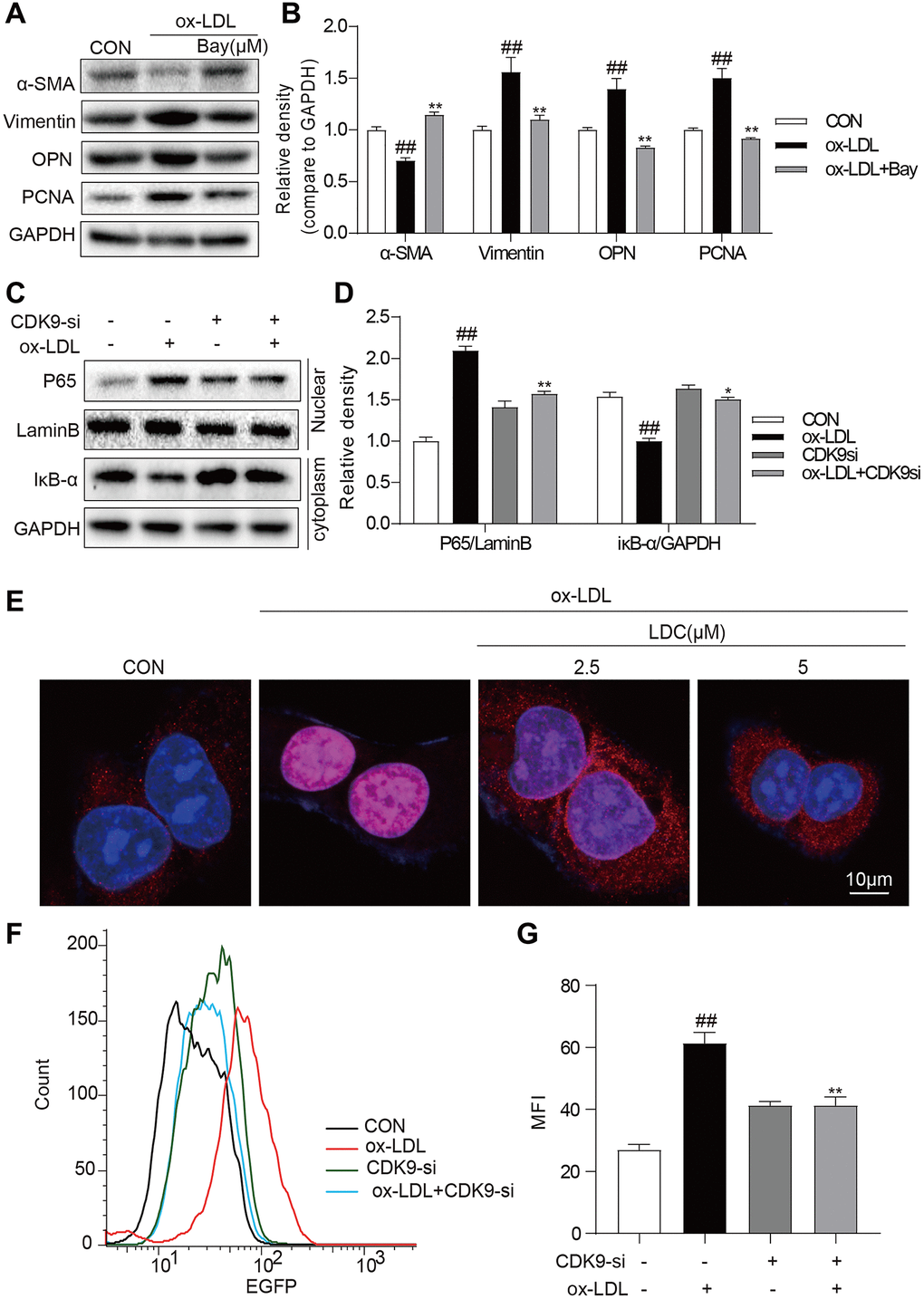 CDK9 inhibitor reduces inflammatory responses and phenotype switch of VSMCs exposed to ox-LDL by suppressing NF-κB pathway. (A–B) VSMCs were treated with the Bay (10μM) for 1 h, and then stimulated with ox-LDL (50μg/mL) for 24 h. The expressions of α-SMA, Vimentin, and PCNA were detected by western blot ((n = 3; ##P *P **P C–D) transfected with siRNA against CDK9 and then incubated with ox-LDL (50 μg/mL) for 1 h. The IκB-α protein level in cell lysate was detected by western blot; and the nuclear fraction was isolated and the nuclear level of NF-κB p65 was measured by western blot (n = 3; ##P *P **P E) VSMCs were pretreated with LDC000067 (2.5 or 5 μM) for 1 h, and then stimulated with ox-LDL (50 μg/mL) for 1 h. Nuclear translocation of NF-κB p65 was measured by immunofluorescence staining (scale bar = 10 μm). (F–G) NF-κB-RE-EGFP reporter VSMCs were transfected with siRNA against CDK9 and then stimulated with ox-LDL (50 μg/mL) for 6 h. NF-κB activity is shown as mean fluorescence intensity (MFI) in flow cytometry histogram (n = 3; ##P **P 