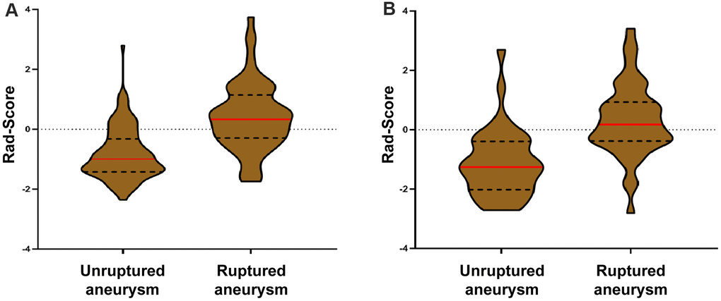 Violin plots of the radiomics signature score (rad-score). There was a significant difference in the rad-score between unruptured IA and ruptured IA in the derivation cohort (p A), which was then confirmed in the validation cohort (p B).