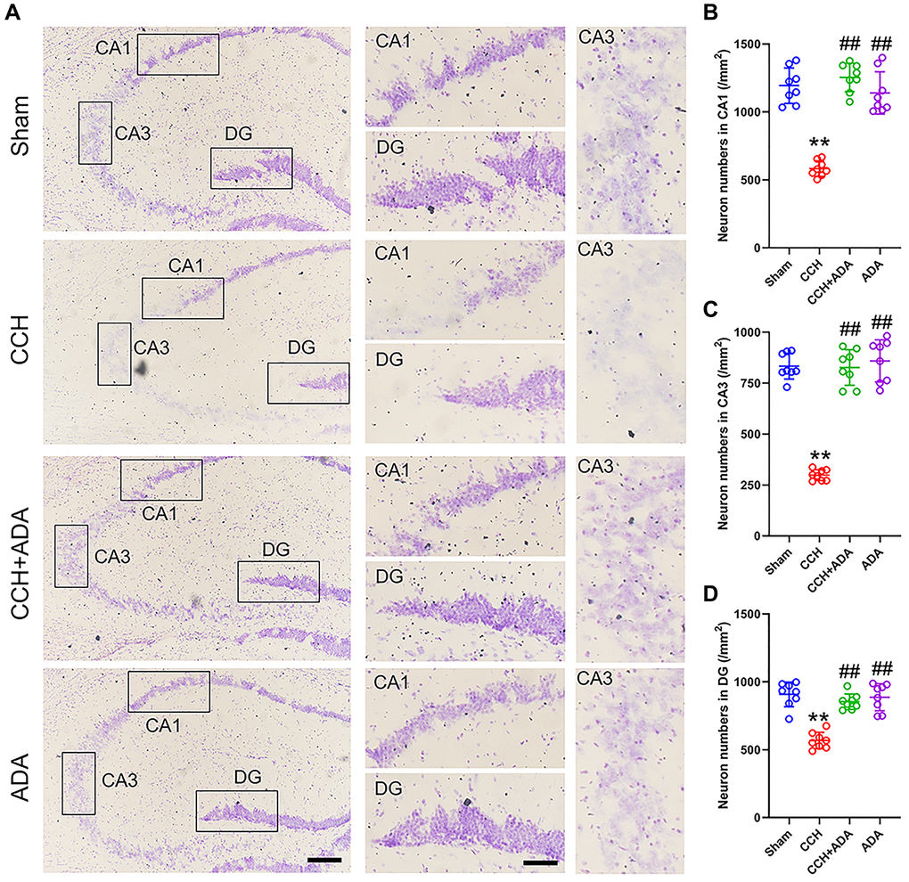 ADA rescued neuronal loss in CCH rats. (A) Representative images of Nissl staining for the different groups. Left: the whole hippocampus; Right: magnified images of the CA1, CA3 and DG regions. Bar = 100 μm for the left panel and 20 μm for the right panel. (B–D) Quantification of neuron number in the different groups in the CA1 (B), CA3 (C) and DG (D) regions. All values are expressed as the mean ± SEM (n = 8). **p ##p 