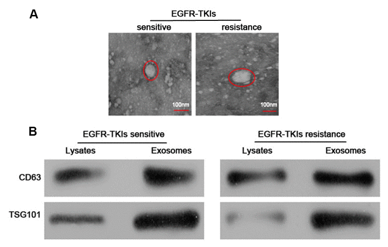 Identification and characterization of serum exosomes. (A) Representative electron micrographs of serum exosomes obtained by TEM analysis (right, bars=100 nm). (B) Western blots analysis of exosomal markers, including CD63 and TSG101 in exosomes and cell lysates.