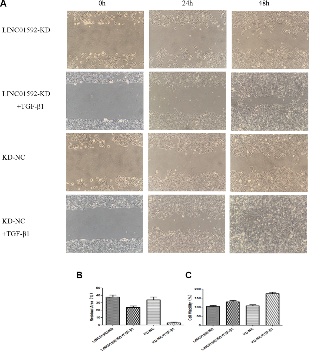 Knockdown of LINC01592 decreased the proliferation and migration of RPE cells. Migration of RPE cells in each group was observed under a microscope at 0, 24, and 48 h (A). The residual scratch area of RPE cells in each group after transfection and induction by TGF-β1 for 48 h (B). Viability of RPE cells was detected by CCK-8 after transfection and induction by TGF-β1 for 48 h (C). The difference of expression levels between groups was statistically significant (P  0.05).