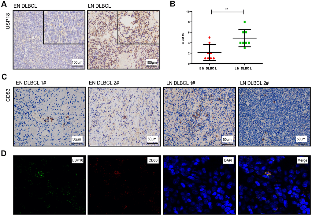 The expression of USP18 protein in EN and LN DLBCL patients. (A) The expression of USP18 protein in EN and LN DLBCL by IHC staining. (B) The H-score of USP18 in tumor tissues of EN and LN DLBCL. (C) The expression of CD83 protein in EN and LN DLBCL by IHC staining. (D) The immunofluorescence double labeled staining of USP18 and CD83 in DLBCL tissues.