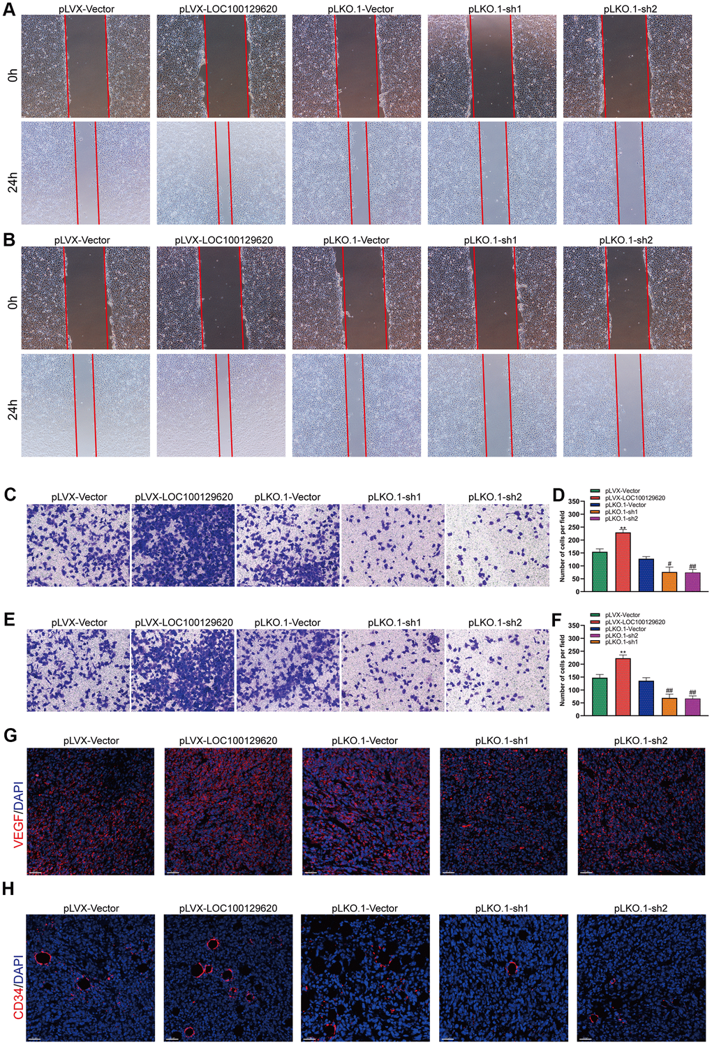 LncRNA LOC100129620 regulates osteosarcoma-induced angiogenesis. (A) Cell scratch assay to detect the migration ability of HUVECs treated with cell culture supernatant from U2OS cells with LOC100129620 overexpression or knockdown. (B) Cell scratch assay to detect the migration ability of HUVECs treated with cell culture supernatant isolated from MG63 cells with LOC100129620 overexpression or knockdown. (C) Transwell assay to detect the invasion ability of HUVECs treated with cell culture supernatant isolated from U2OS cells with LOC100129620 overexpression or knockdown. (D) Quantitative analysis of the Transwell assay results of HUVECs treated with cell culture supernatant isolated from U2OS cells with LOC100129620 overexpression or knockdown. (E) Transwell assay to detect the invasion ability of HUVECs treated with cell culture supernatant isolated from MG63 cells with LOC100129620 overexpression or knockdown. (F) Quantitative analysis of the Transwell assay results of HUVECs treated with cell culture supernatant isolated from MG63 cells with LOC100129620 overexpression or knockdown. Statistical analysis was conducted using Student’s t-test. (G) Immunofluorescence analysis to detect the expression of VEGF in xenograft tumor. (H) Immunofluorescence analysis to detect the expression of CD34 in xenograft tumor. Values are means ± SD. **P ##P 
