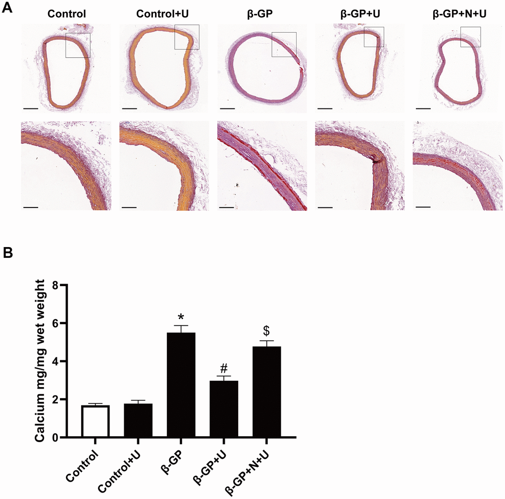 Effects of κ-OR stimulation on β-GP-induced mineralization in aortic rings from rats. (A) Representative Alizarin red-stained sections of aortic rings from rats; Scale bar = 500 μm (above panel) and 100 μm (below panel). (B) Quantification of mineralization in the aortic rings using the O-cresol phthalein complex one assay. Aortic rings from rats were incubated in control medium (Con; serum-free DMEM), phosphate medium (β-GP; serum-free DMEM + 10 mmol/L β-GP), phosphate medium + U50,488H (40 mmol/L), or phosphate medium + nor-BNI (80 mmol/L) + U50,488H (40 mmol/L) for ten days. U, U50,488H; β-GP, β-Glycerophosphate disodium salt pentahydrate; N, nor-BNI; Data are shown as mean ± SEM and were analyzed using one-way ANOVA tests. n = 4 in each group. *P #P $P 