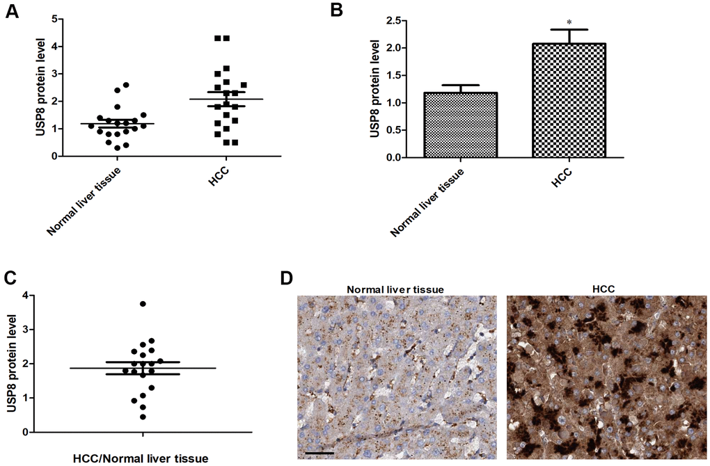 USP8 expression is upregulated in HCC patients. (A) Scatter plot of USP8 protein level in individual HCC and normal liver (n=20). (B) The average level of USP8 protein in HCC and normal liver (n=20). (C) USP8 protein ratio of tumor and adjacent normal in individual HCC patients (n=20). (D) Representative images of immunohistochemical staining for USP8 in paired normal liver and HCC. Nuclear is stained with hematoxylin. Scale bar is 10 μM. USP8 protein level was normalized with total protein amount. *, p