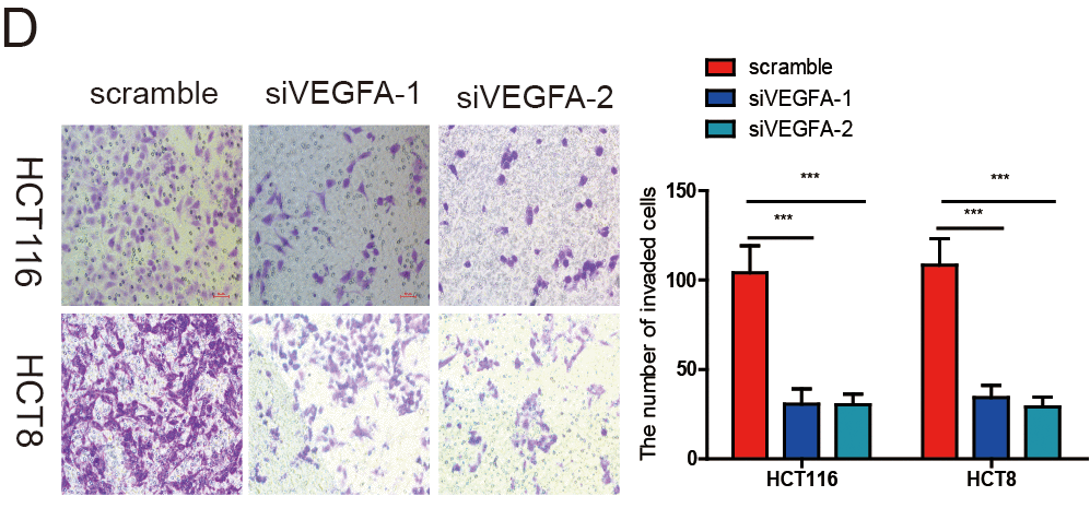 VEGFA knockdown significantly inhibited CRC progression. (A) VEGFA expression was downregulated in HCT116 and HCT8 cells transfected with siVEGFA-1 or siVEGFA-2. (B-E) VEGFA knockdown inhibited CRC cell proliferation (B), migration (C), invasion (D) and HUVECs tube formation (E). Data are shown as the meanv±SD of three independent experiments. *p