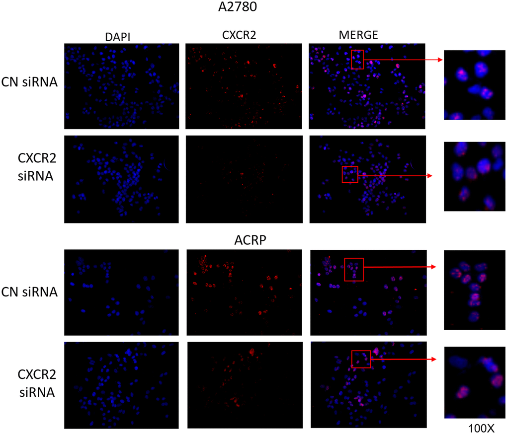 CXCR2 comprises persistent nuclei anomalous expression cisplatin resistant OC cells. Immunofluorescence assays were performed to investigate cellular localization of CXCR2 expression in OC cells. CXCR2 antibody (red) whereas cellular nuclei were stained with DAPI (blue); images where further merged to facilitate cellular localization analysis. Cells were plated at same density (left column of Figure). As previously demonstrated, CXCR2 was overexpressed in ACRP cells in comparison with A2780 cells (middle column of Figure). N=3. Images were acquired under 10x magnification.