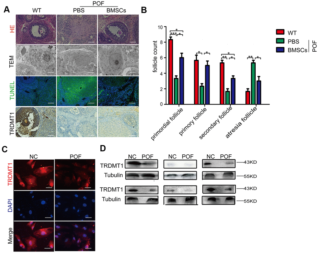 Reduced TRDMT1 is associated with decreased ovarian function. (A) Histopathological examination of the ovaries of the WT, POF-PBS and POF-BMSCs groups. Scale bar: 100 μm. (B) Primordial follicles, primary follicles, secondary follicles, and atretic follicles were observed. (A) Transmission electron microscopy analysis of the ovarian structures in each group of mice. Scale bar: 2μm. (A) Apoptosis of GCs in ovaries was measured by TUNEL staining. Representative images of terminal deoxynucleotidyl transferase dUTP nick end labeling (TUNEL) staining show apoptotic GCs in each group. The TUNEL-positive apoptotic cells are indicated by green fluorescence. The nuclei (blue) were stained with DAPI. Scale bar: 100μm. (A) Representative immunohistochemical images of TRDMT1 in each group. Brown staining represents a positive TRDMT1 signal. Scale bar: 100μm. (C) Representative immunofluorescent staining of TRDMT1 in GCs from women with normal ovarian function and from patients with POF. Nuclei were stained with DAPI. Scale bar: 50μm. (D) TRDMT1 expression in the serum of healthy people and patients with POF was detected by Western blotting. An anti-Tubulin antibody was used as a loading control. *p