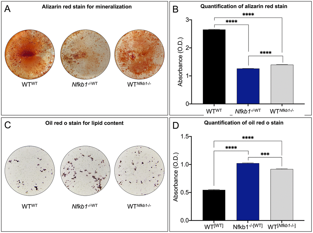 Increased NF-κB-mediated inflammation leads to impaired differentiation potential. (A, B) Osteogenic potential was assessed by Alizarin red staining (A), which demonstrated significantly reduced mineralization in Nfkb1-/-WT and WTNfkb1-/- samples compared to control (B) (n=3, **** P ). (C, D) Significantly increased lipid accumulation was observed in Nfkb1-/-WT and WTNfkb1-/- samples as revealed by Oil Red O staining (C) and quantification (D) (n=3, *** P ≤ 0.001, **** P ≤ 0.0001).