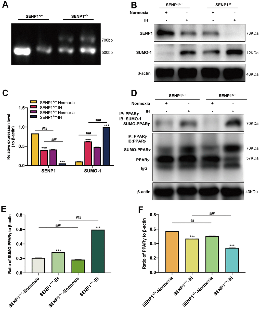 SENP1 depletion promotes the SUMOylation of peroxisome proliferator-activated receptor-γ (PPARγ) in mice under intermittent hypoxia (IH) condition. (A) The genotype of mice was identified by agarose gel electrophoresis. (B, C) The expression of SENP1 and SUMO-1 in mice with or without SENP1 knockdown under normoxic and IH conditions. ***p ###p +/+-IH group. (D–F) The effects of IH on the SUMOylation of PPARγ (D, E) and the level of PPARγ (D, F) were detected by co-immunoprecipitation followed by western blot analysis. ***p ##p ###p +/+-IH group. Normoxia: mice were treated under normoxic condition. IH: mice were exposed under IH. SENP1+/+, wild type mice; SENP1+/−, SENP1 knockdown mice.
