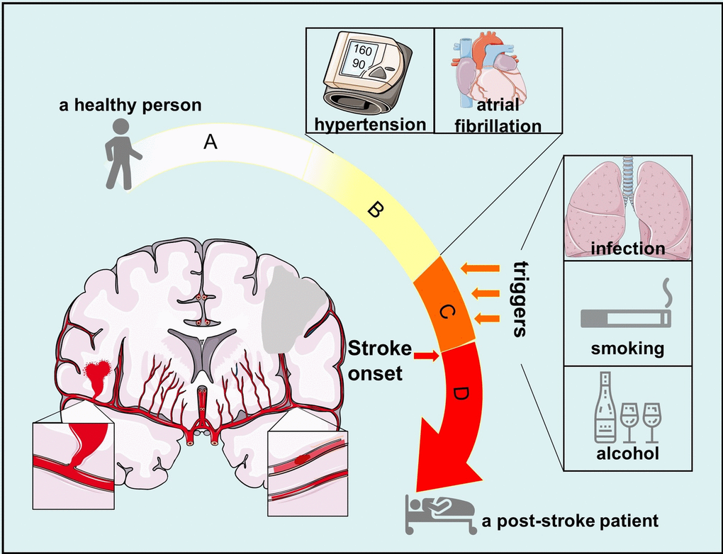 Process from normal status to post-stroke status. (A) normal status when a person is healthy and has no chronic disease; (B) status when a person suffers from diseases that are risk factors of stroke, including hypertension, atrial fibrillation and so on; (C) stroke-prone status when outside attacks such as infection and alcohol can trigger stroke onset in a person with risk factors of stroke; (D) post-stroke status when a person has suffered from stroke onset.