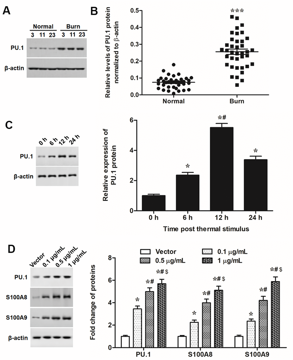PU.1 was upregulated in burned skin and promoted expression of S100A8/A9. (A) Representative blots for PU.1 in burned and matched normal skin tissues from burn patients. (B) Comparison of PU.1 in burned and matched normal skin tissues of 38 patients. Primary keratinocytes were treated with PU.1 adenoviral expression vector at amounts of 0.1, 0.5 and 1 μg. Empty adenoviral vector was applied as a negative control. After transfection for 48 h, expression levels of (C) PU.1 protein and (D) EMT marker proteins in thermal-stimulated keratinocytes at different time points. *P #P 