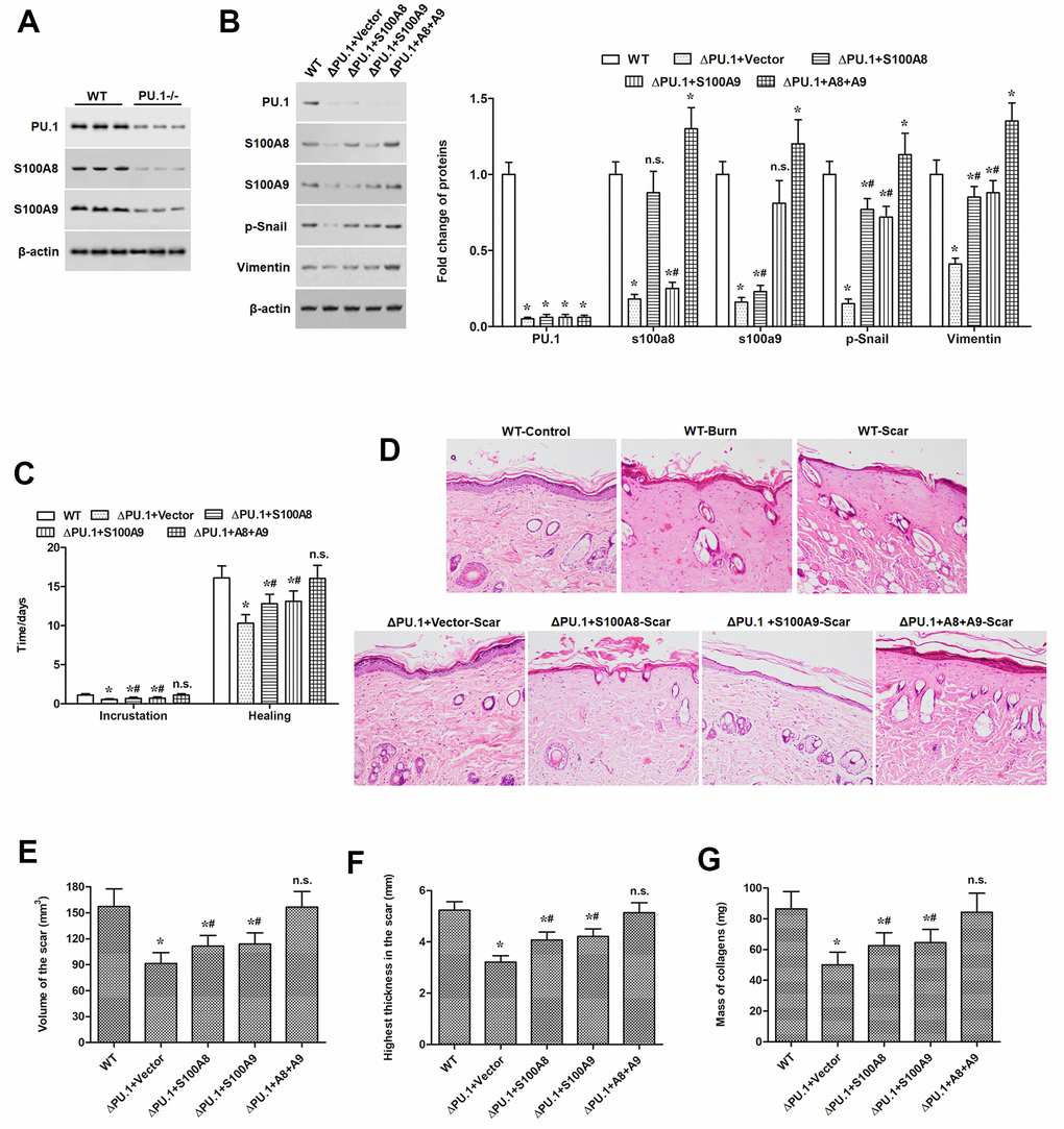 S100A8 and S100A9 promoted scar development in PU.1-/- burn model mice. (A) expression of PU.1, S100A8 and S100A9 proteins in the skin of WT and skin-specific PU.1 knockout (PU.1-/- or ΔPU.1) mouse. The effect of overexpression of S100A8 or/and S100A9 on (B) expression of EMT marker proteins, (C) time of wound healing, (D) histopathological changes (by HE staining), (E) scar volume, (F) scar thickness, and (G) contents of collagens in PU.1-/- burn model mice. *P #P 