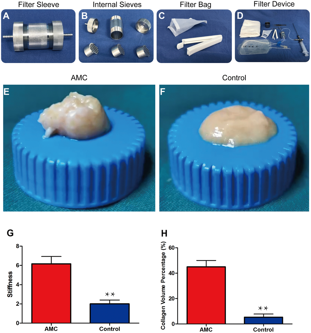 Preparation and physical properties of AMC. (A) Filter sleeve used to separate and collect AMC. (B) Three sieves inside the filter sleeve. (C) Filter bag (100 mesh) for dehydrating AMC. (D) The entire filter device used to prepare AMC. (E, F) Appearance of AMC and Coleman fat (control) before grafting. (G) Stiffness analysis of AMC and Coleman fat (control) before grafting. (H) Collagen volume percentage of AMC and Coleman fat (control) before grafting. Results are presented as the mean ± SD (n = 7 per group). ** control vs. AMC; P 