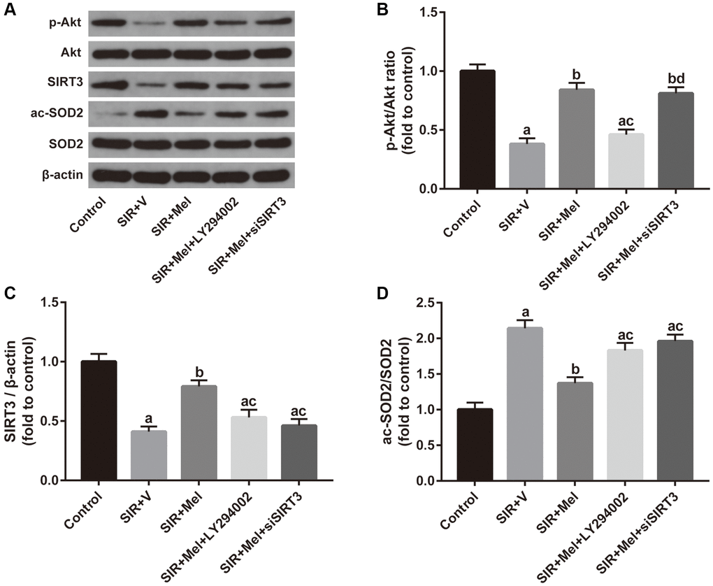 Correlation between the Akt signaling and the SIRT3/SOD2 signaling in mediating the neuroprotective actions of melatonin. (A) Representative images for Akt phosphorylation, SIRT3 expression, and SOD2 acetylation detected by Western blot. (B–D) Quantitative analysis of the ratio of p-Akt/Akt, expression of SIRT3, and the ratio of ac-SOD2/SOD2. Data were presented as the mean ± SEM (n = 6). ap bp cp dp 