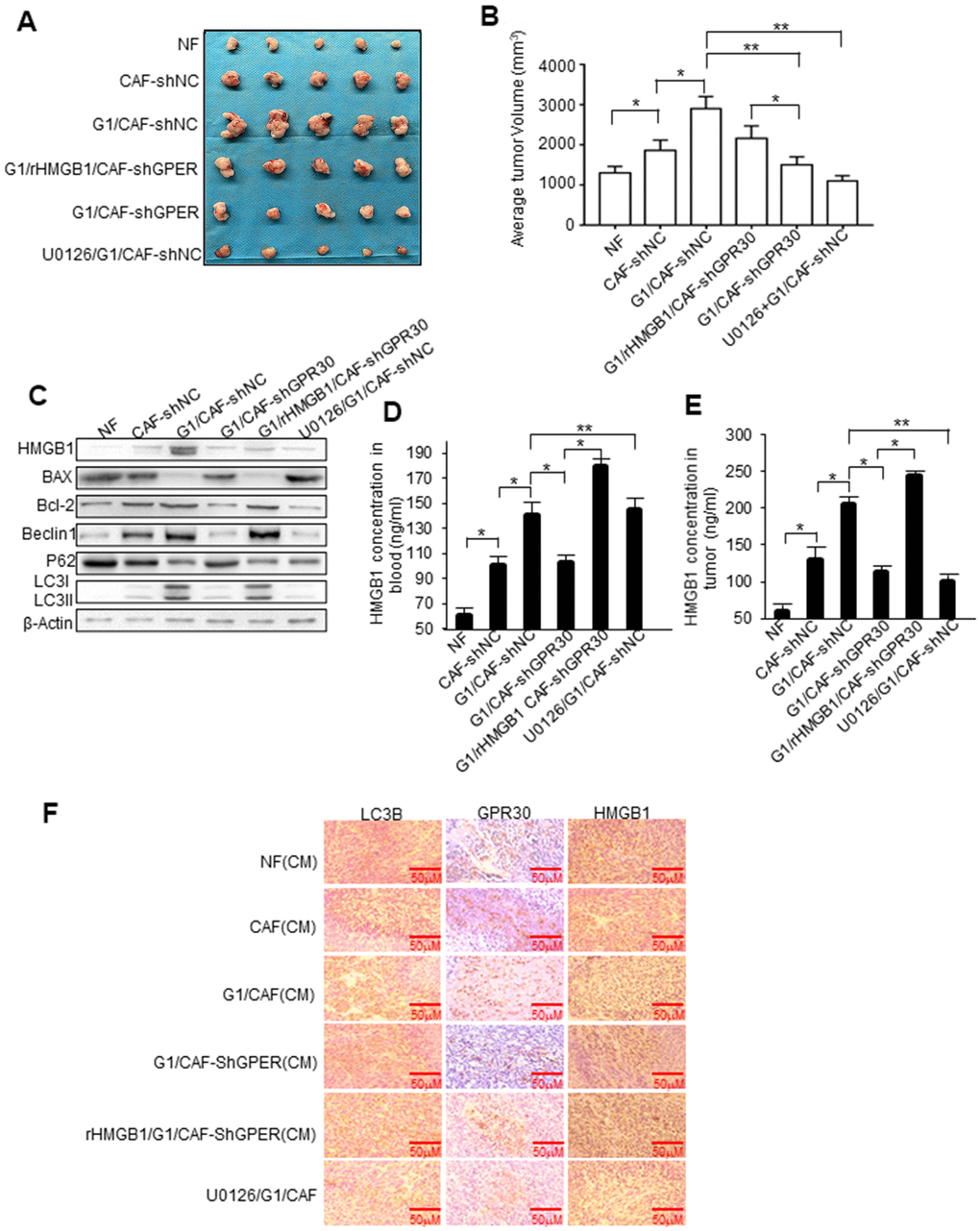 HMGB1-induced autophagy is required for mammary tumor resistance to tamoxifen in mice. MCF-7 cells mixed with CAFs or engineered CAFs (CAF/sh-NC, CAF/sh-GPR30) were subcutaneously transplanted into nude mice. Mice were treated with tamoxifen as described in the Materials and Methods. (A) Tumor size in mice; mean ± SE of triplicate representative experiments. (B) Tumor volume was assessed. (C) Autophagy- and apoptosis-related markers in xenografts were quantified by western blotting. U0126 injected into mice at 25 mmol/kg. (D, E) The concentration of HMGB1 in xenograft tissues and blood from mice. (F) Representative images of LC3B, GPR30, and HMGB1 examined by IHC staining are shown; Scale bar, 50 μm.