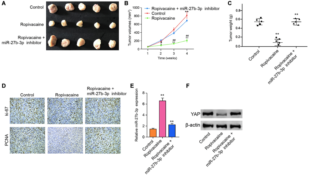 Ropivacaine attenuates the tumor growth of breast cancer in vivo. (A–F) The effect of ropivacaine on tumor growth of breast cancer cells in vivo was analyzed by nude mice tumorigenicity assay by injected with the MDA-MB-231 cells. The mice (n = 5) were treated with equal volume saline, or ropivacaine (40 μmol/Kg), or co-treated with ropivacaine (40 μmol/Kg) and miR-27b-3p inhibitor. (A) Representative images of dissected tumors from nude mice were presented. (B) The average tumor volume was calculated and shown. (C) The average tumor weight was calculated and shown. (D) The levels of ki-67 and PCNA were measured by immunohistochemistry analysis in the mice. (E) The expression levels of miR-27b-3p were examined by qPCR assays in the tumor tissues of the mice. (F) The expression levels of YAP were measured by qPCR assays in the tumor tissues of the mice. Data are presented as mean ± SD. Statistic significant differences were indicated: ##P **P 