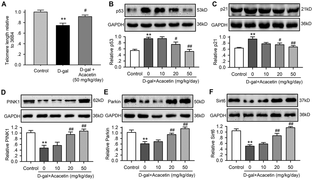 Acacetin effects on myocardial telomere length and proteins related to aging and autophagy in senescence mouse model induced by D-galactose. (A) Myocardial telomere length determined by qRT-PCR in mice treated without (control) or with D-galactose (D-gal, 150 mg/kg/day) or D-galactose with acacetin (50 mg/kg/day). (B) Western blots and relative levels of p53 protein in ventricular tissues of mice treated without (control) or with D-galactose or D-galactose with oral 10, 20 or 50 mg/kg acacetin. (C) Western blots and relative levels of p21 protein in ventricular tissues of mice treated as in (B). (D) Western blots and relative levels of PINK1 protein in ventricular tissues of mice treated as in (B). (E) Western blots and relative levels of Parkin protein in ventricular tissues of mice treated as in (B). (F) Western blots and relative levels of Sirt6 protein in ventricular tissues of mice treated as in (B) (n = 6, **P #P ##P 