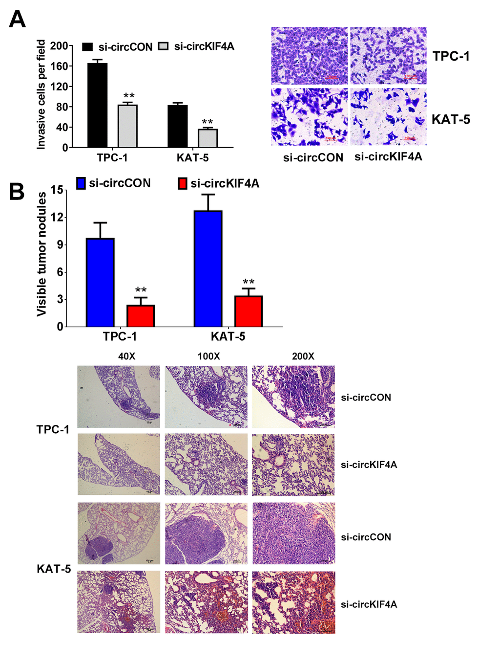 Downregulation of circKIF4A suppresses the metastasis of papillary thyroid cancer cells. (A) Transwell experiments were conducted in TPC-1 and KAT-5 cell line. (B) The number of lung metastases was counted and recorded. HE-stained sections of lung metastases were presented.