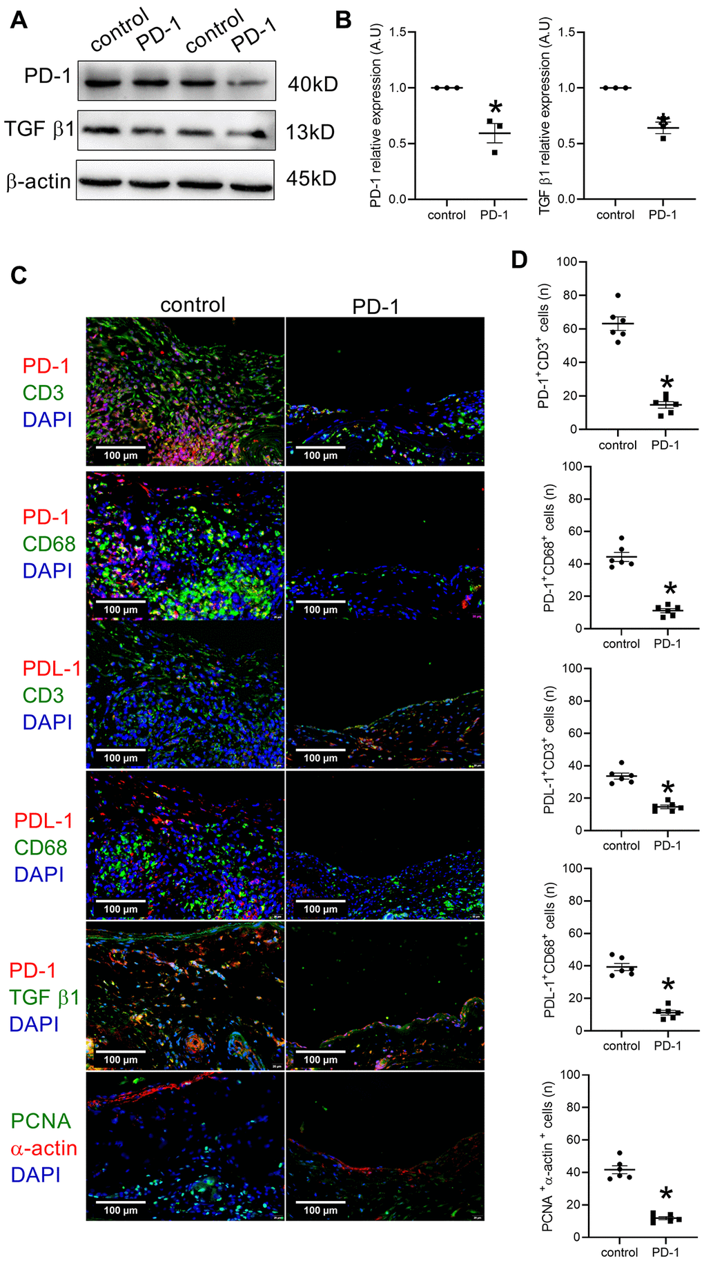 Intraperitoneal (IP) injection of PD-1 antibody decreases PD-1 expression after patch venoplasty in rats. (A) Western blot showing the expression of PD-1 and TGF β1 after the intraperitoneal injection of the PD-1 antibody in rat IVCs and neointimas at day 14; n = 3. (B) Bar graph showing PD-1 (*p = 0.0096, t-test) and TGF β1 (*p = 0.0023, t-test) density; n = 3. (C) Merged immunofluorescence images showing CD3 (green), PD-1 (red) and DAPI (blue); CD68 (green), PD-1 (red) and DAPI (blue); CD3 (green), PDL-1 (red) and DAPI (blue); CD68 (green), PDL-1 (red) and DAPI (blue); TGF β1 (green), PD-1 (red) and DAPI (blue); PCNA (green), α-actin (red) and DAPI (blue); scale bar, 100 μm; n = 6. (D) Bar graphs showing CD3 and PD-1 dual-positive cells (*p t-test); CD68 and PD-1 dual-positive cells (*p t-test), CD3 and PDL-1 dual-positive cells (*p t-test); CD68 and PDL-1 dual-positive cells (*p t-test), PCNA and α-actin dual-positive cells (*p t-test); n = 6.