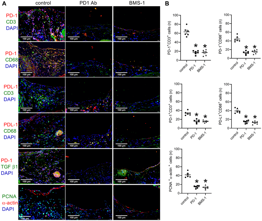PD-1- and BMS-1-coated patches decrease PD-1 expression after patch venoplasty in rats. (A) Merged immunofluorescence images showing CD3 (green), PD-1 (red) and DAPI (blue); CD68 (green), PD-1 (red) and DAPI (blue); CD3 (green), PDL-1 (red) and DAPI (blue); CD68 (green), PDL-1 (red) and DAPI (blue); TGF β1 (green), PD-1 (red) and DAPI (blue); PCNA (green), α-actin (red) and DAPI (blue); scale bar, 100 μm; n = 6. (B) Bar graphs showing CD3 and PD-1 dual-positive cells (p *p p *p p *p p *p = p *p n = 6.