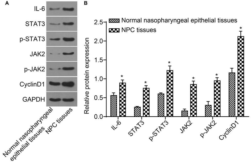 The protein expressions of IL-6, STAT3, JAK2, and CyclinD1 as well as the extent of STAT3 and JAK2 phosphorylation in NPC tissues were higher. (A) The protein band detected by western blot analysis; (B) Densitometry analysis of Western blot data. *p n = 117); Normal nasopharyngeal epithelial tissues (n = 112). Abbreviation: NPC: nasopharyngeal carcinoma.