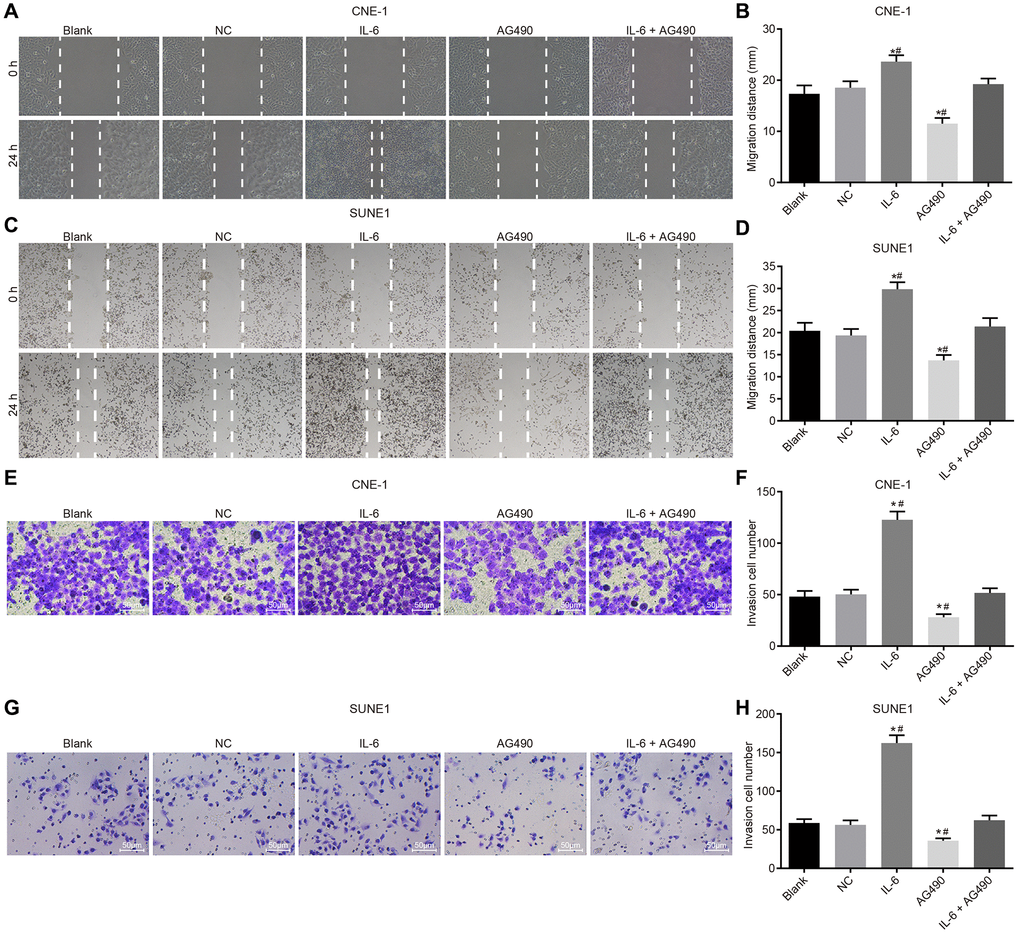 IL-6 enhances NPC cell migration and invasion in vitro. (A) Cell migration of CNE-1 cells (×40); (B) Migration distance of CNE-1 cells; (C) Cell invasion of SUNE-1 cells (×40); (D) Migration distance of SUNE1 cells; (E) Cell invasion of CNE-1 cells (×200); (F) The number of invasive CNE-1 cells; (G) Cell invasion of SUNE1 cells (×200); (H) The number of invasive SUNE1 cells. *p #p 