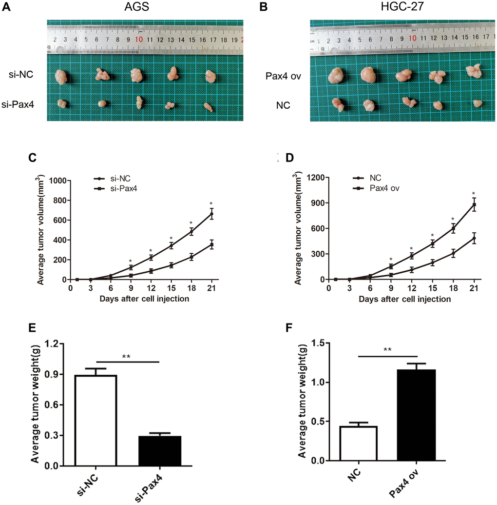 PAX4 overexpression promoted GC tumor growth in vivo. (A–B) Subcutaneous tumor records of the si-PAX4 group and PAX4 ov group. (C–D) The average tumor volume curves indicated that silencing PAX4 can inhibit tumor growth and upregulation of PAX4 can promote tumor growth. (E–F) Knockdown of PAX4 led to the lighter average tumor weight (P = 0.0039) and upregulating PAX4 led to an average heavier tumor weight (P = 0.0017).
