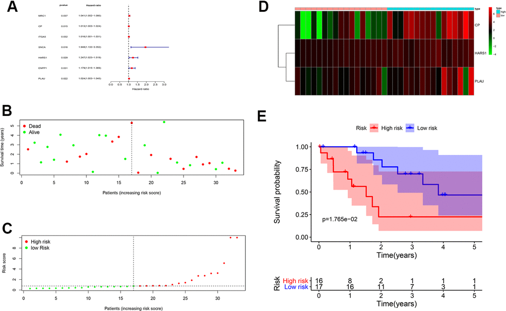 Prognostic value of CHOL/COVID-19-associated genes. (A) Univariate Cox analysis of 7 CHOL/COVID-19-associated genes, including MRC1, CP, ITGA5, SNCA, HARS1, ENPP1, and PLAU. (p B) Survival analysis indicated no difference in the overall survival between high- and low-risk groups of CHOL patients. (C) Analysis of patients’ risk score using Cox proportional hazards regression showed the increasing risk score in the CHOL patients with high risk. (D) Heatmap showed the overexpression of CP, HARS1 and PLAU in the CHOL patients with high risk as compared to those with low risk. (E) The CHOL patients from high-risk group had a poor overall survival rate as compared to those from low-risk group.