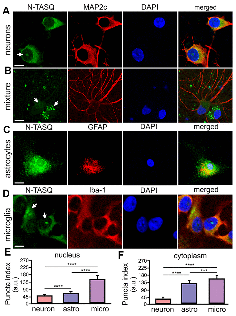 G4 landscapes vary among primary neurons, astrocytes, and microglia. (A) Primary cortical neurons (14 DIV) were fixed and stained with 25 μM N-TASQ, antibodies against MAP2c, and the nuclear dye DAPI, and imaged with a confocal microscope. Note the N-TASQ-positive structure in the nucleus of the cell on the left (depicted with arrow). Scale bar, 5 μm. (B) Primary cortical cultures were stained and imaged as in (A). Note the MAP2c-positive neurons on the right that contain small N-TASQ-positive puncta in the cytoplasm (depicted with arrow). Note the MAP2c-negative cell on the right that contains many N-TASQ-positive puncta in the cytoplasm (depicted with arrow). Scale bar, 10 μm. (C) Cultured primary astrocytes were fixed, stained with 25 μM N-TASQ, antibodies against GFAP, and DAPI, and imaged with a confocal microscope. Note numerous N-TASQ-positive structures in the nucleus and cytoplasm. Scale bar, 10 μm. (D) Cultured primary microglial cells were fixed, stained with 25 μM N-TASQ, antibodies against Iba-1, and DAPI, and imaged with a confocal microscope. Note N-TASQ-positive structures in the nuclei and the cytoplasm (depicted with arrows). Scale bar, 5 μm. (E) The nuclear puncta index of the N-TASQ staining was analyzed in the nuclei of cells from (A), (C, D). The Kruskal-Wallis test was used. ****pF) The cytoplasmic puncta index of the N-TASQ staining was analyzed in the cytoplasm of cells from (A), (C, D). The Kruskal-Wallis test was used. ****p