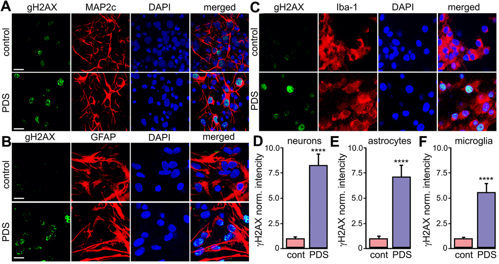 PDS induces DNA DSBs in primary neurons, astrocytes, and microglia. (A) Primary cortical neurons were treated with a vehicle (upper panel; control) or with 2 μM PDS (lower panel; PDS) overnight, fixed, and stained for a marker of DNA DSBs phosphorylated histone H2A variant X, γH2A.X (green), MAP2c (red), and with the nuclear DAPI dye (blue). Samples were imaged with a confocal microscope. Scale bar is 10 μm. (B) Primary astrocytes were treated with a vehicle (upper panel; control) or with 2 μM PDS (lower panel; PDS) overnight, fixed, and stained for γH2A.X (green), GFAP (red), and with DAPI (blue). Samples were imaged with a confocal microscope. Scale bar is 10 μm. (C) Primary microglial cells were treated with a vehicle (upper panel; control) or with 2 μM PDS (lower panel; PDS) overnight, fixed, and stained for γH2A.X (green), Iba-1 (red), and with the nuclear DAPI dye (blue). Samples were imaged with a confocal microscope. Scale bar is 10 μm. (D) The γH2A.X intensities were measured in images from (A) and normalized (arbitrary units). ****pE) The γH2A.X intensities were measured in images from (B) and normalized (arbitrary units). ****pF) The γH2A.X intensities were measured in images from (C) and normalized (arbitrary units). ****p